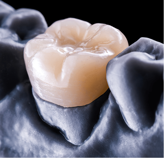 crowns@1.2x Dentist in Emerson, NJ