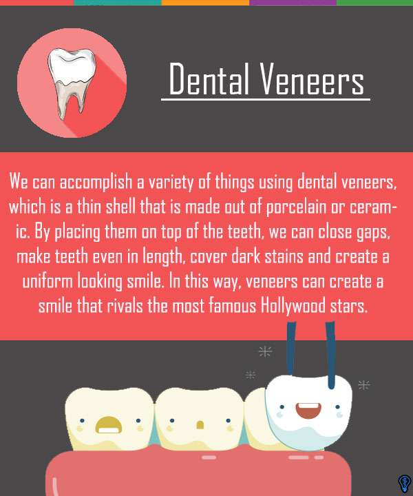 Dental Veneers and Dental Laminates Emerson, NJ