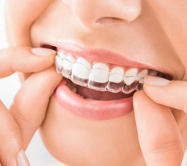 1765983423_does-invisalign-really-work-header Does Invisalign Really Work Emerson, NJ