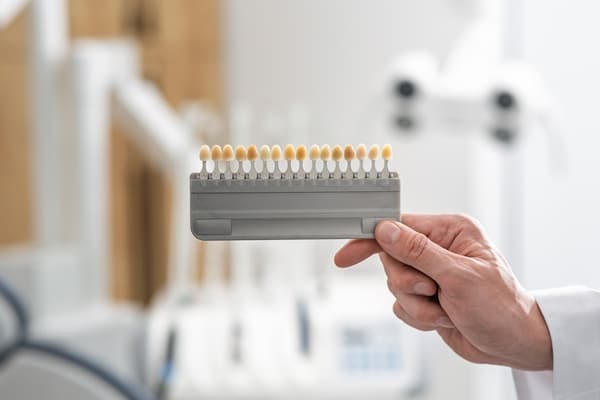 Myths and Facts About Dental Veneers