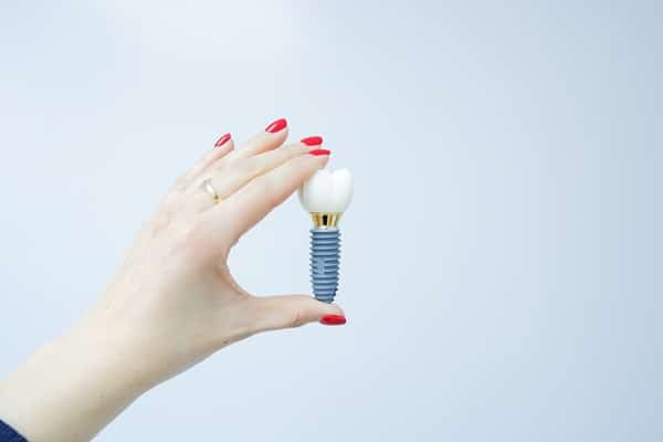 Multiple Dental Implants vs. Dental Bridge