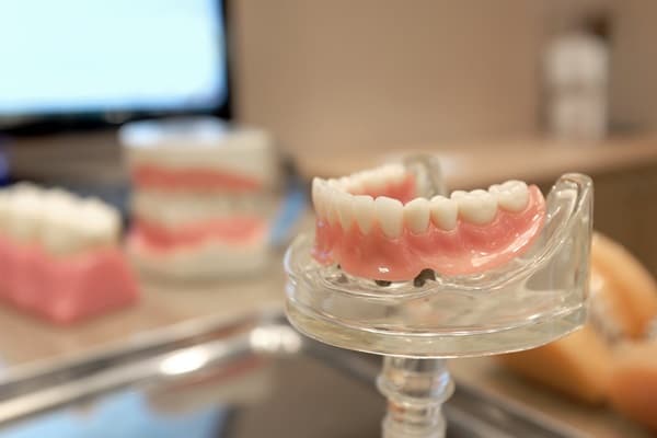 Pros and Cons of All-On-6 Dental Implants