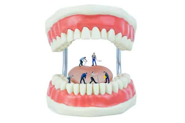 Why It’s Important to Leave Denture Repair to a Dental Professional