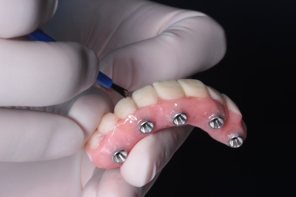All-on-4 Dental Implants Emerson, NJ