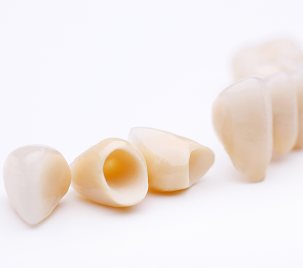 Emerson Dental Crowns and Dental Bridges