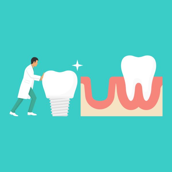 What Does Implant Restoration Entail? [Dental Implants]