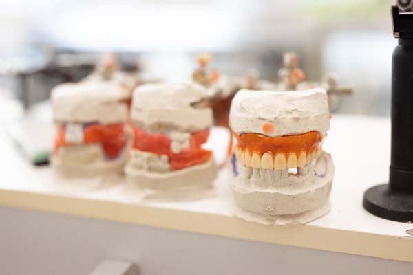 Choosing The Right Dental Professional For Denture Repair