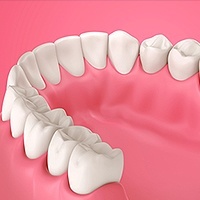 Gum Disease Emerson, NJ