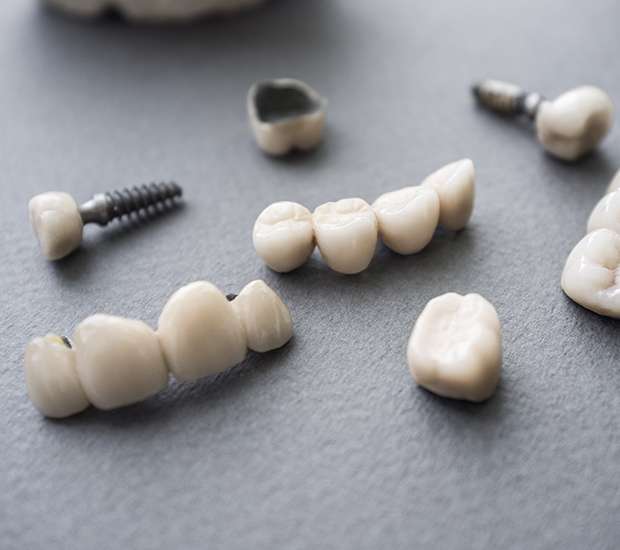 Emerson The Difference Between Dental Implants and Mini Dental Implants