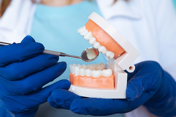 When Do You Need A Dental Checkup?
